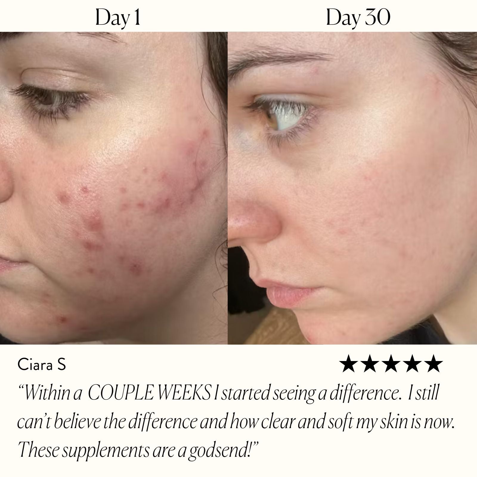 The Skin - Clarity Complex