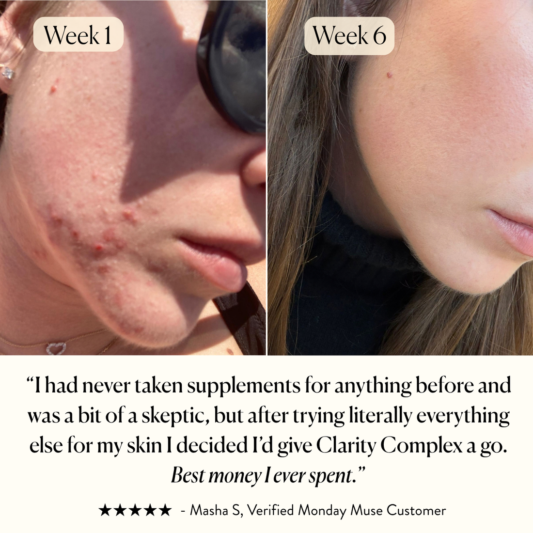 The Skin - Clarity Complex