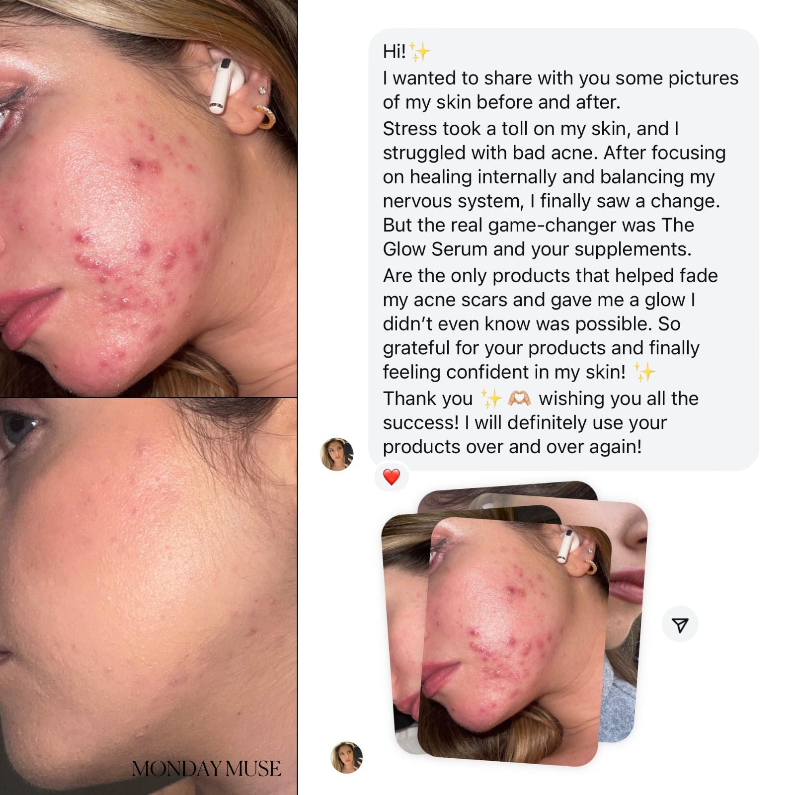 The Skin - Clarity Complex - Monday Muse