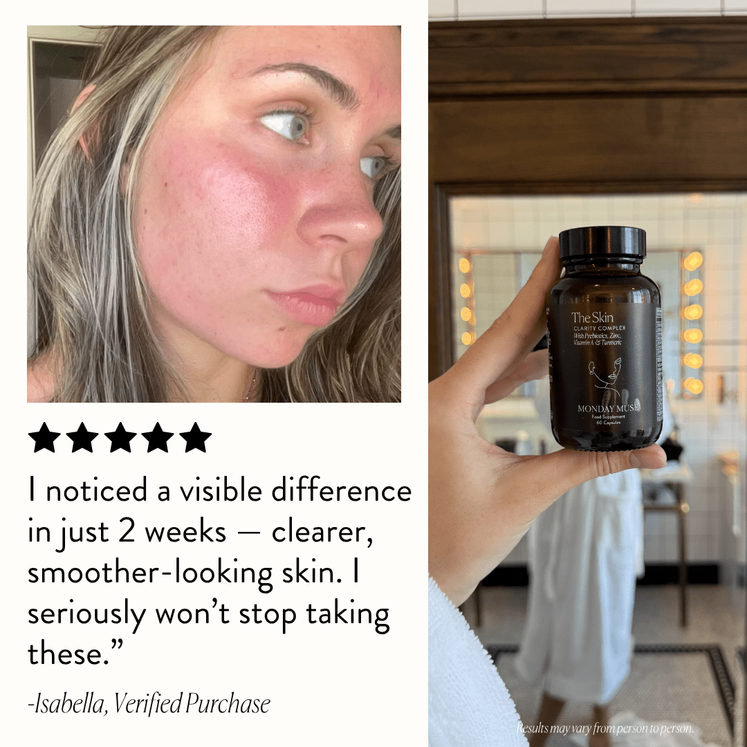 The Skin - Clarity Complex 3 Month Supply - Monday Muse