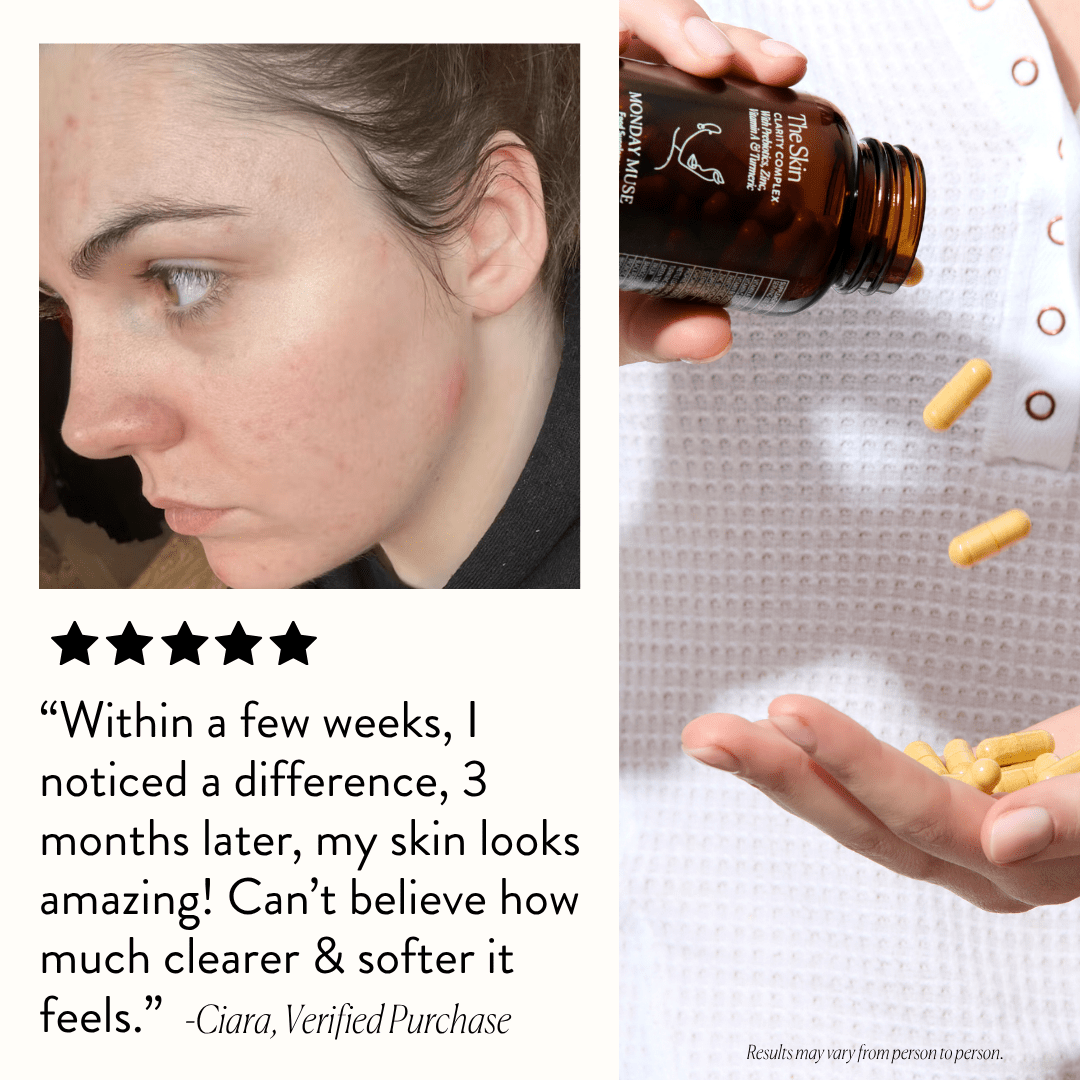 The Skin - Clarity Complex 3 Month Supply - Monday Muse