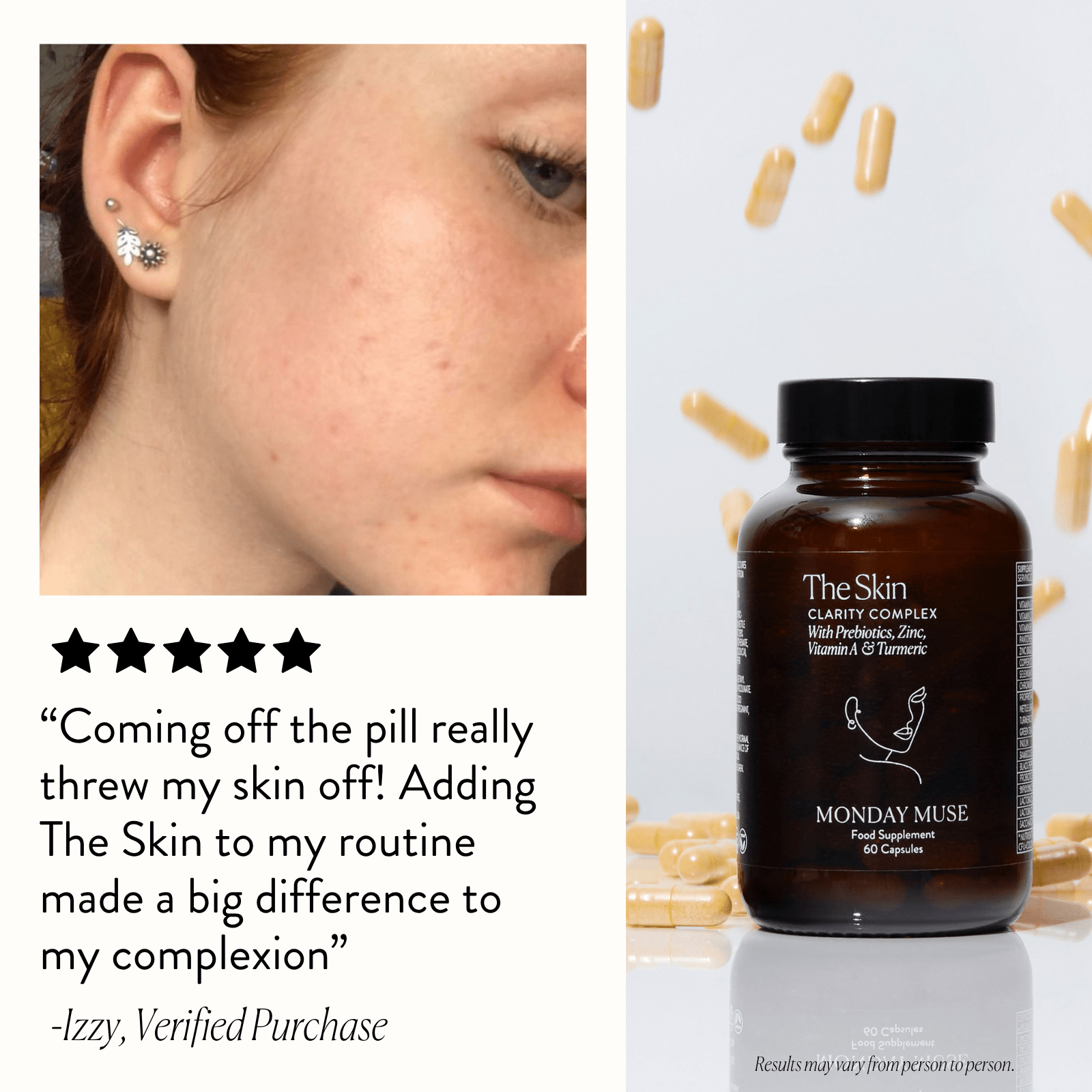The Skin - Clarity Complex - Monday Muse