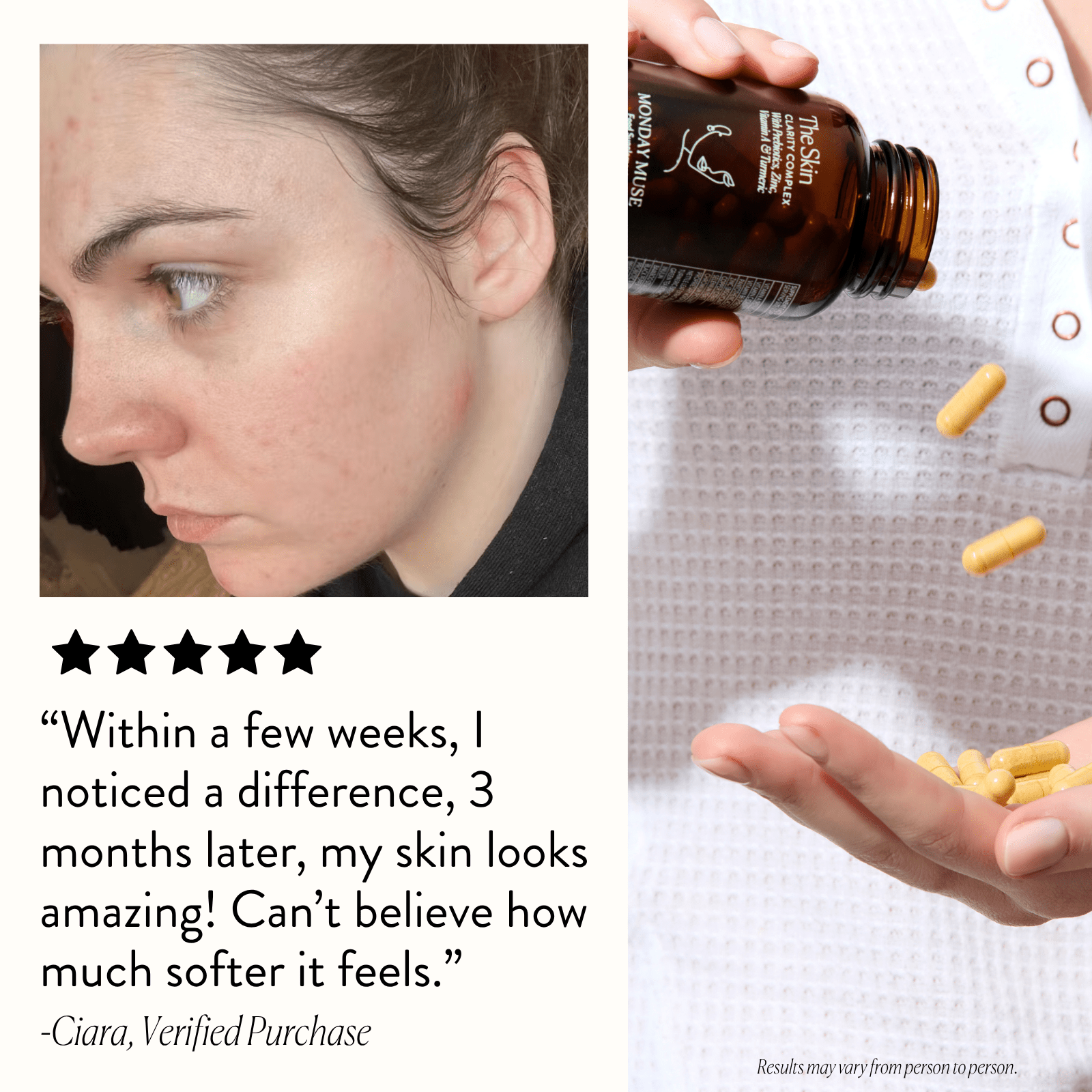 The Skin - Clarity Complex - Monday Muse