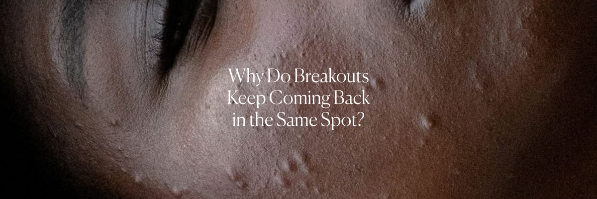 Why Do Breakouts Keep Coming Back in the Same Spot?