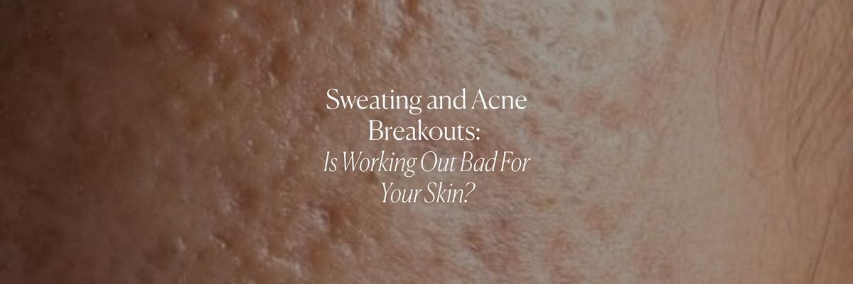Sweating and Acne Breakouts: Is Working Out Bad For Your Skin?