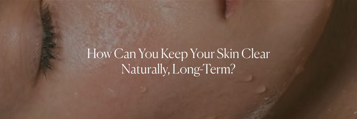 How Can You Keep Your Skin Clear Naturally, Long-Term?