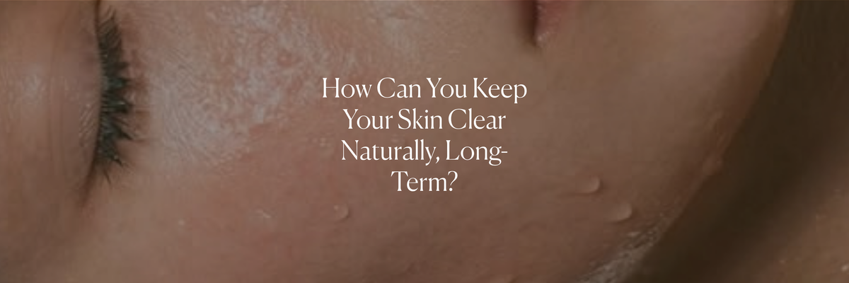 How Can You Keep Your Skin Clear Naturally, Long-Term?