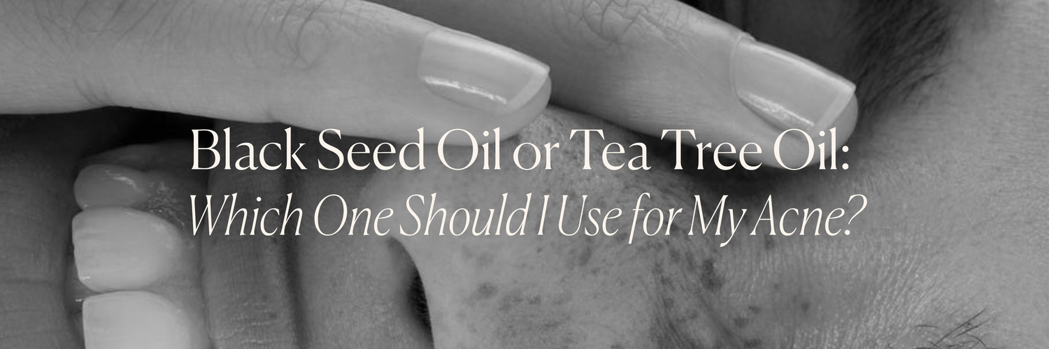 Black Seed Oil or Tea Tree Oil: Which One Should I Use for My Acne?