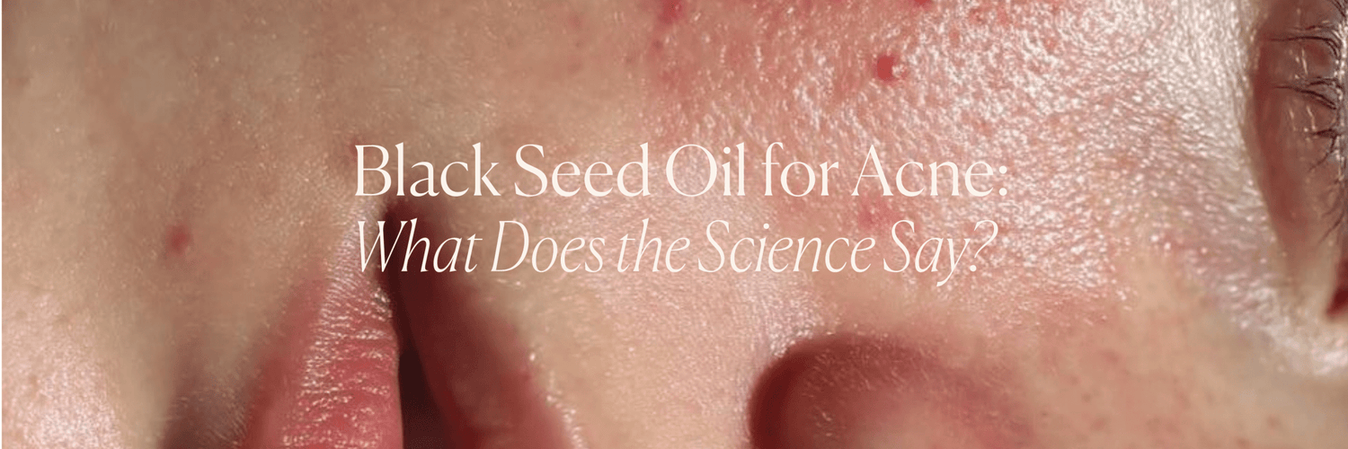 Black Seed Oil for Acne: What Does the Science Say? - Monday Muse