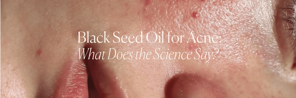 Black Seed Oil for Acne: What Does the Science Say? - Monday Muse