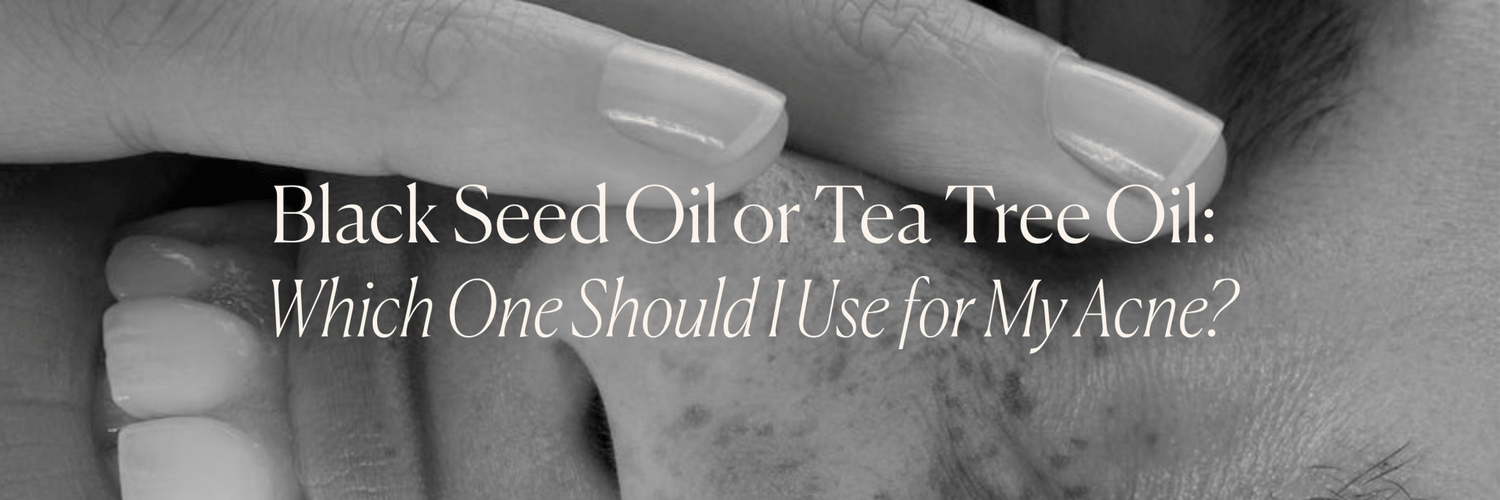 Black Seed Oil or Tea Tree Oil: Which One Should I Use for My Acne? - Monday Muse