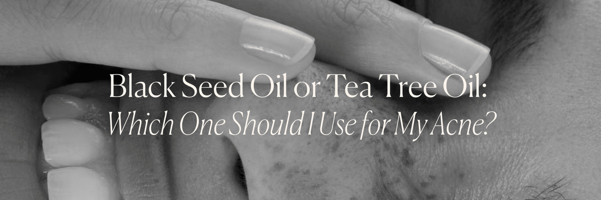 Black Seed Oil or Tea Tree Oil: Which One Should I Use for My Acne? - Monday Muse