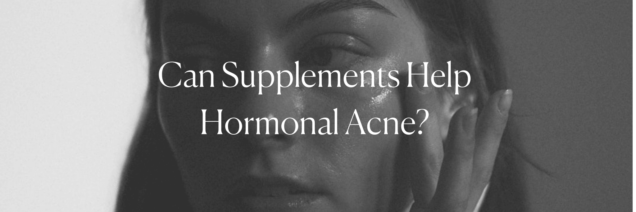 Can Supplements Help Hormonal Acne? - Monday Muse