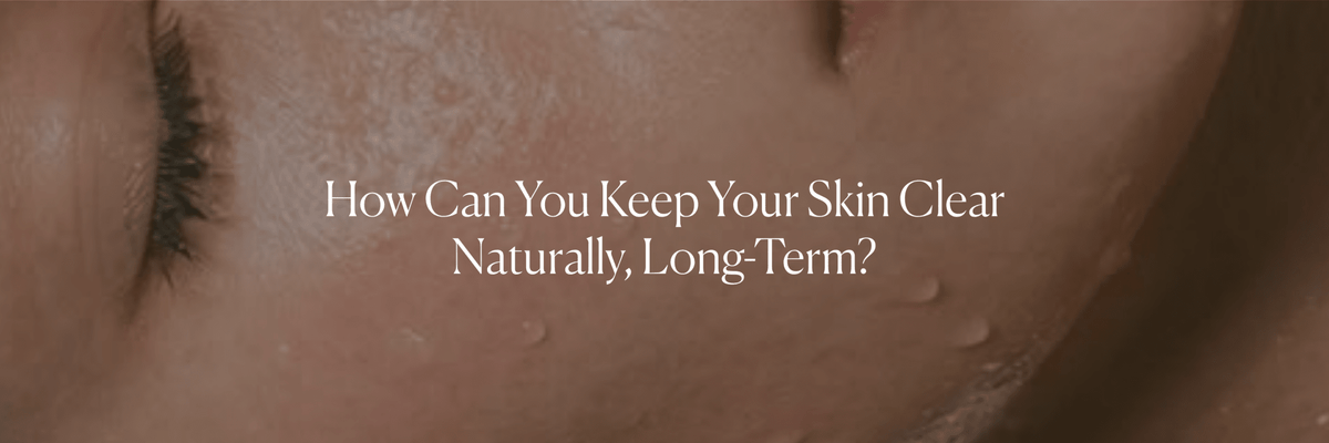 How Can You Keep Your Skin Clear Naturally, Long-Term? - Monday Muse