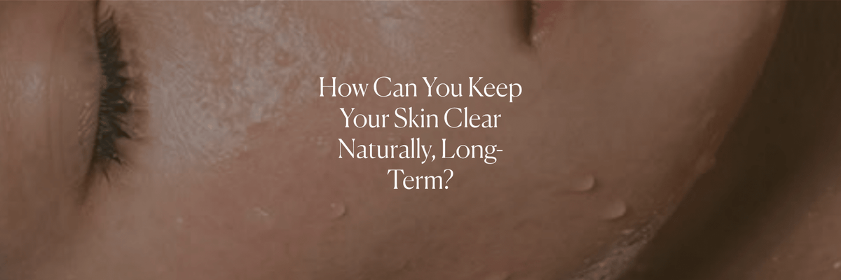 How Can You Keep Your Skin Clear Naturally, Long-Term? - Monday Muse