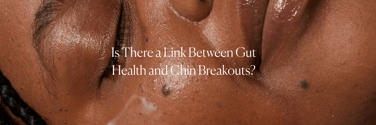 Is There a Link Between Gut Health and Chin Breakouts? - Monday Muse
