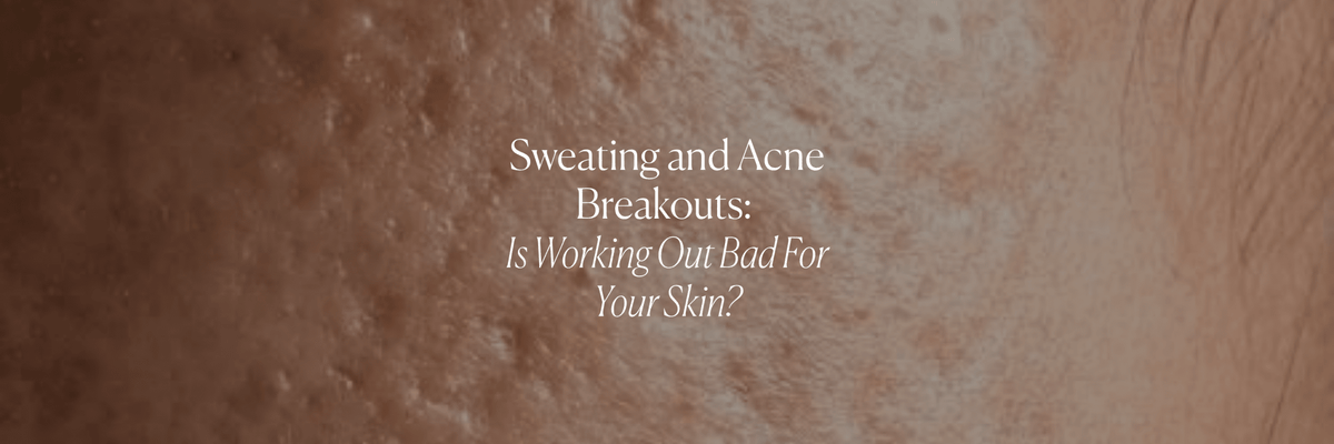 Sweating and Acne Breakouts: Is Working Out Bad For Your Skin? - Monday Muse