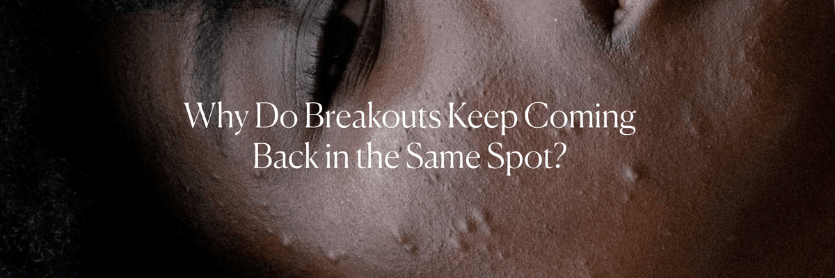 Why Do Breakouts Keep Coming Back in the Same Spot? - Monday Muse