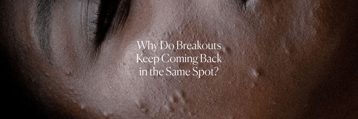 Why Do Breakouts Keep Coming Back in the Same Spot? - Monday Muse