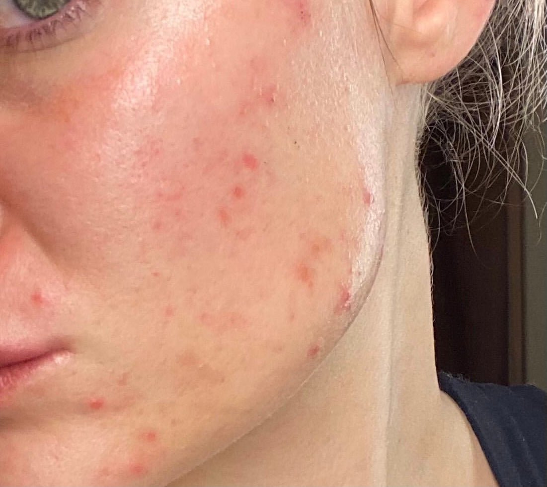 Blemishes &amp; Impurities - Monday Muse