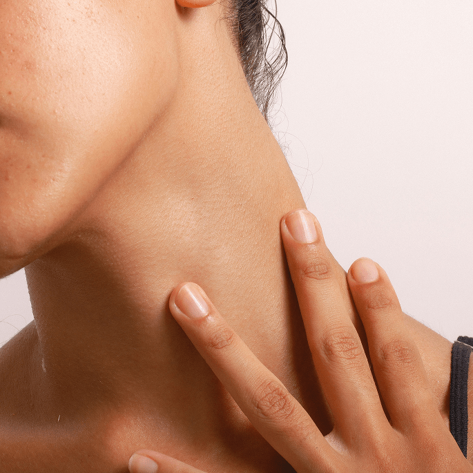 Oily Skin - Monday Muse