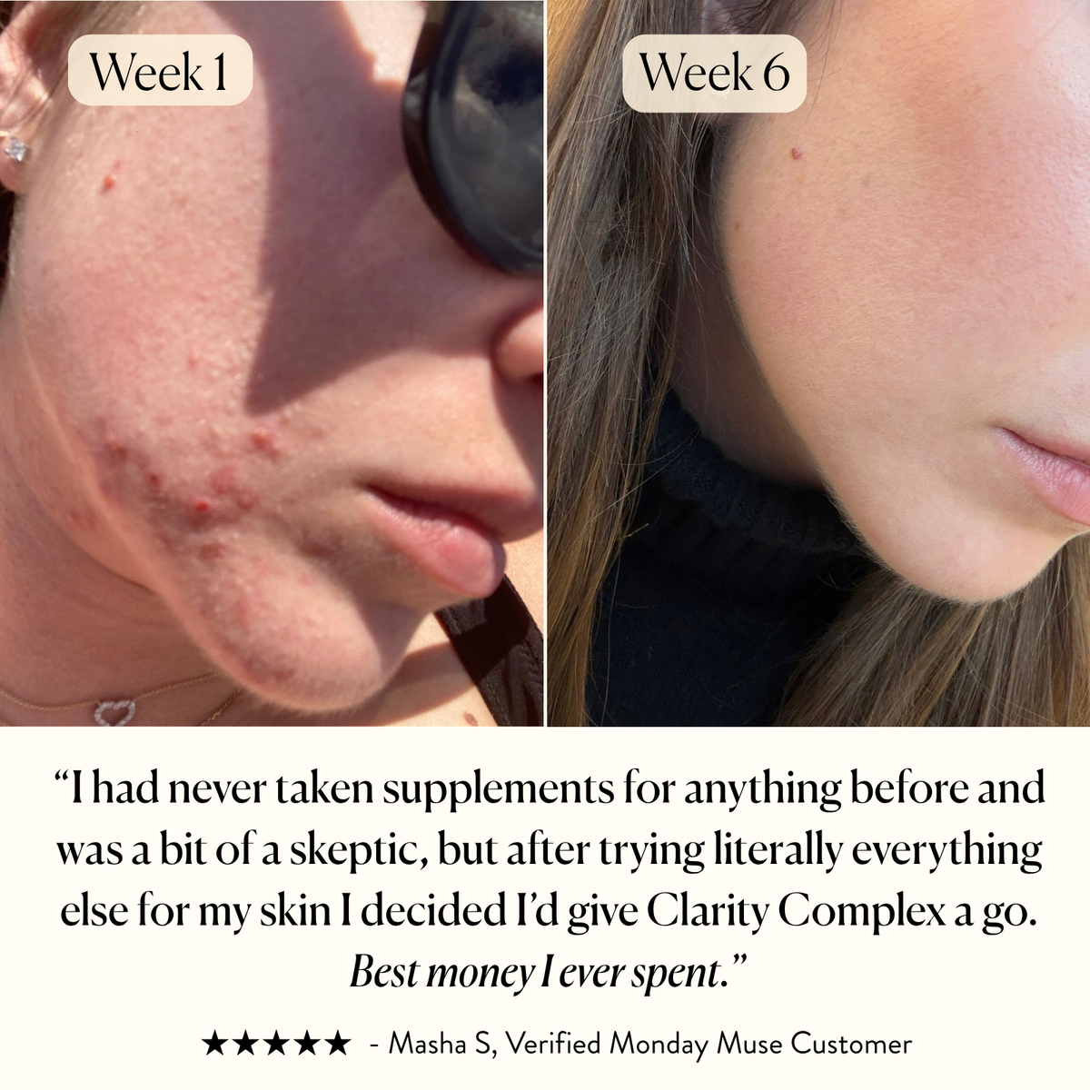 The Skin - Clarity Complex