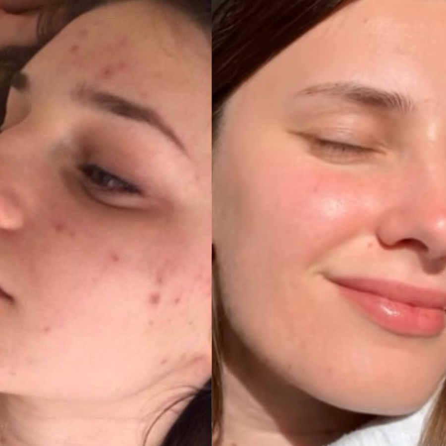Customer before and after