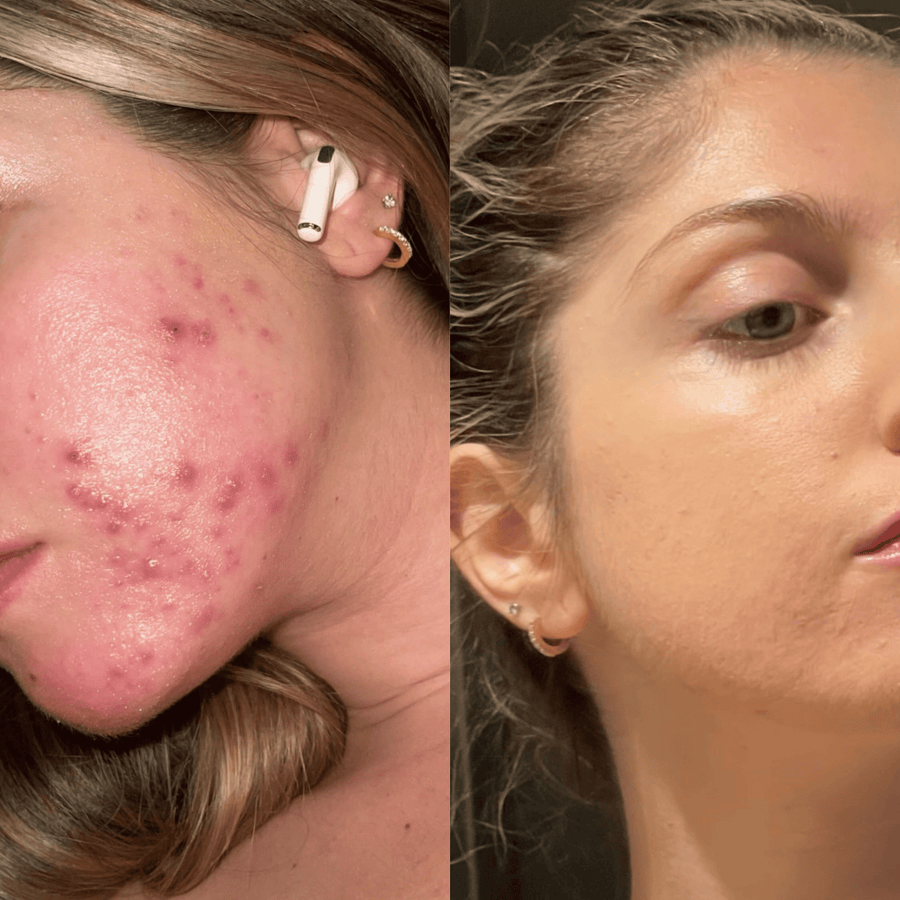 Customer before and after