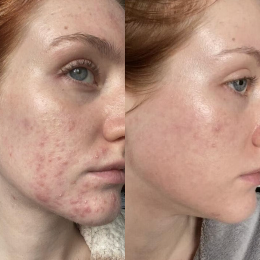 Customer before and after