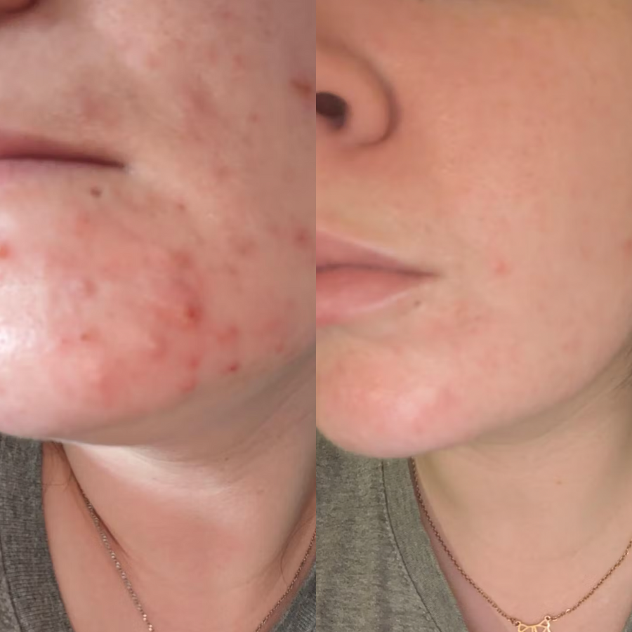 Customer before and after
