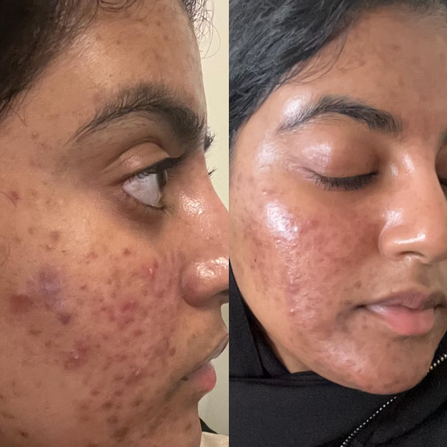 Customer before and after