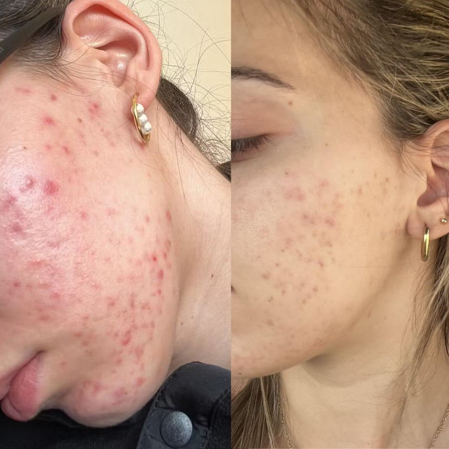 Customer before and after