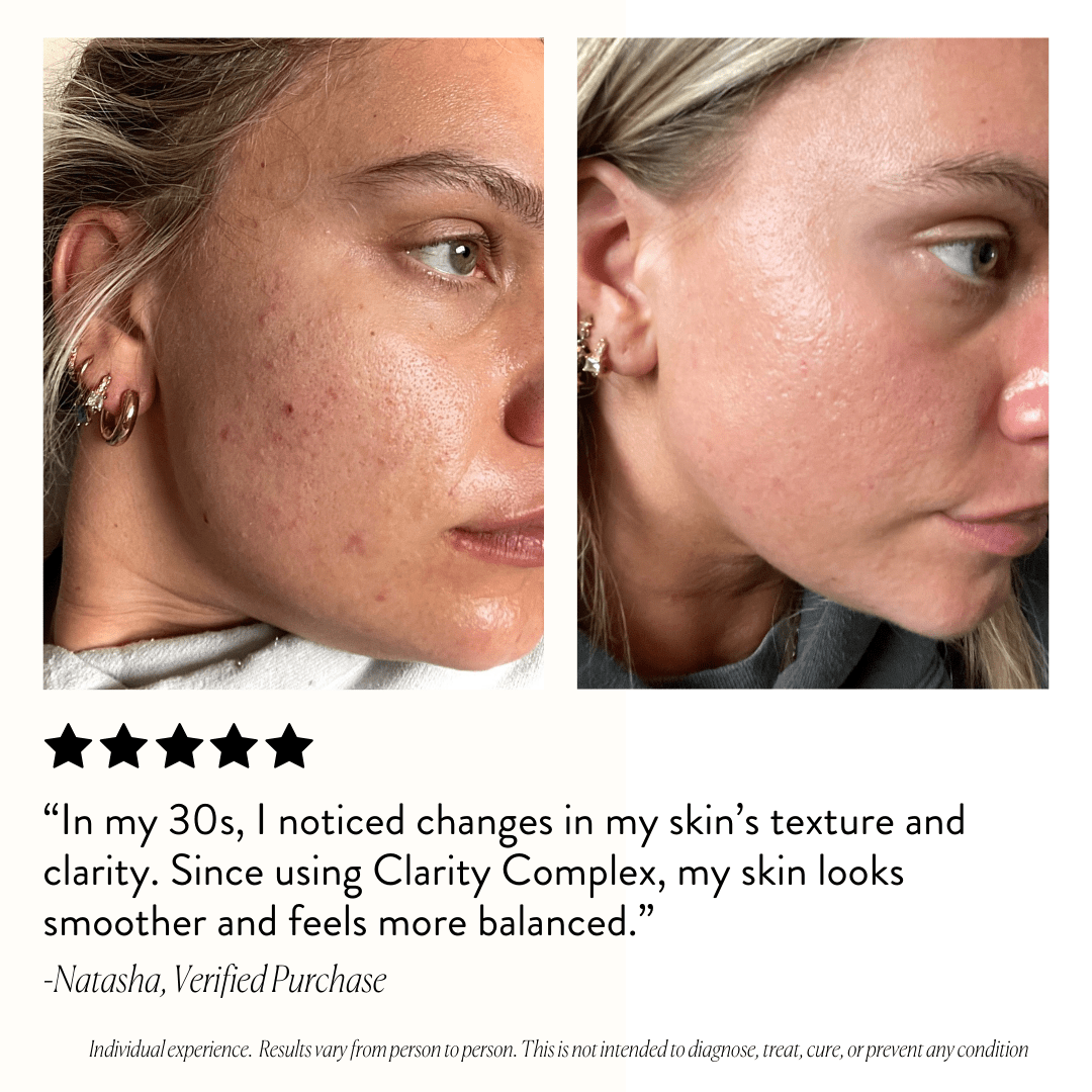The Skin - Clarity Complex 3 Month Supply - Monday Muse