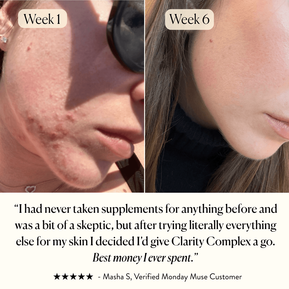 The Skin - Clarity Complex - Monday Muse