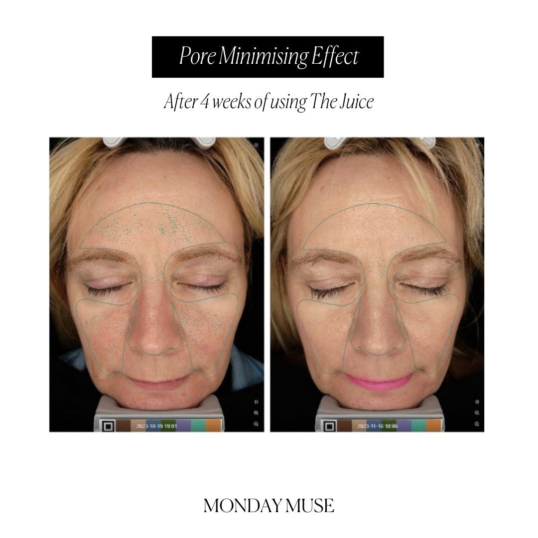 Pore Purifying Bundle - Monday Muse