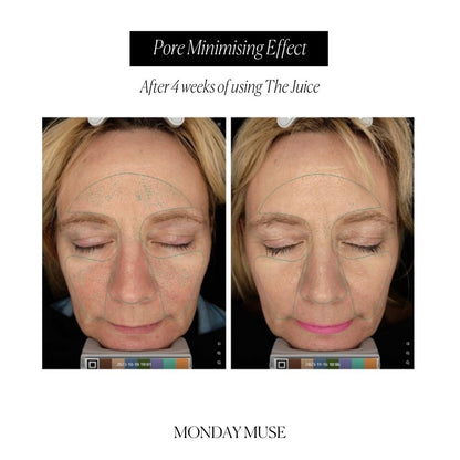 Pore Purifying Bundle - Monday Muse