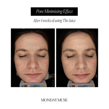 Pore Purifying Bundle - Monday Muse