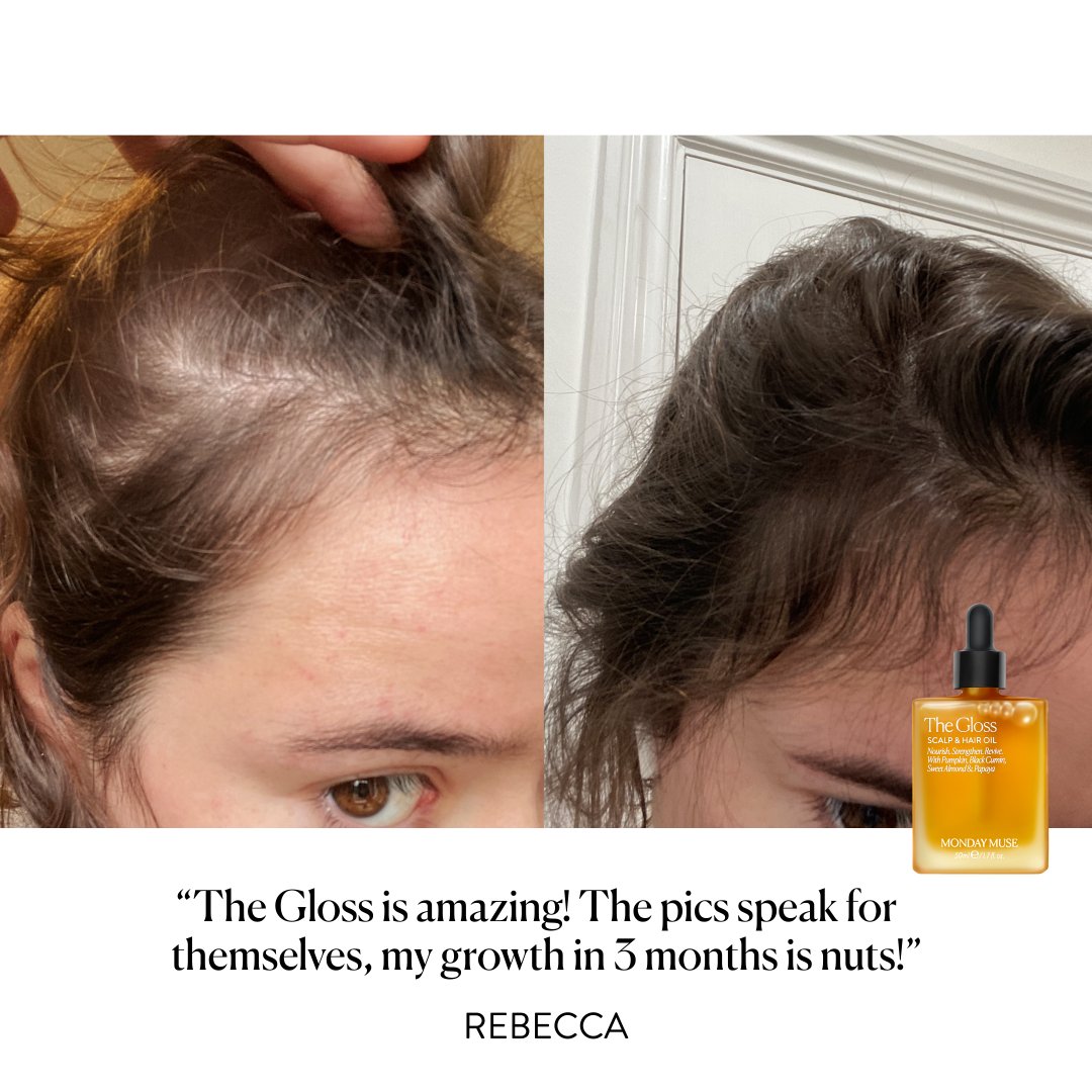 THE GLOSS - Scalp &amp; Hair Oil - Monday Muse
